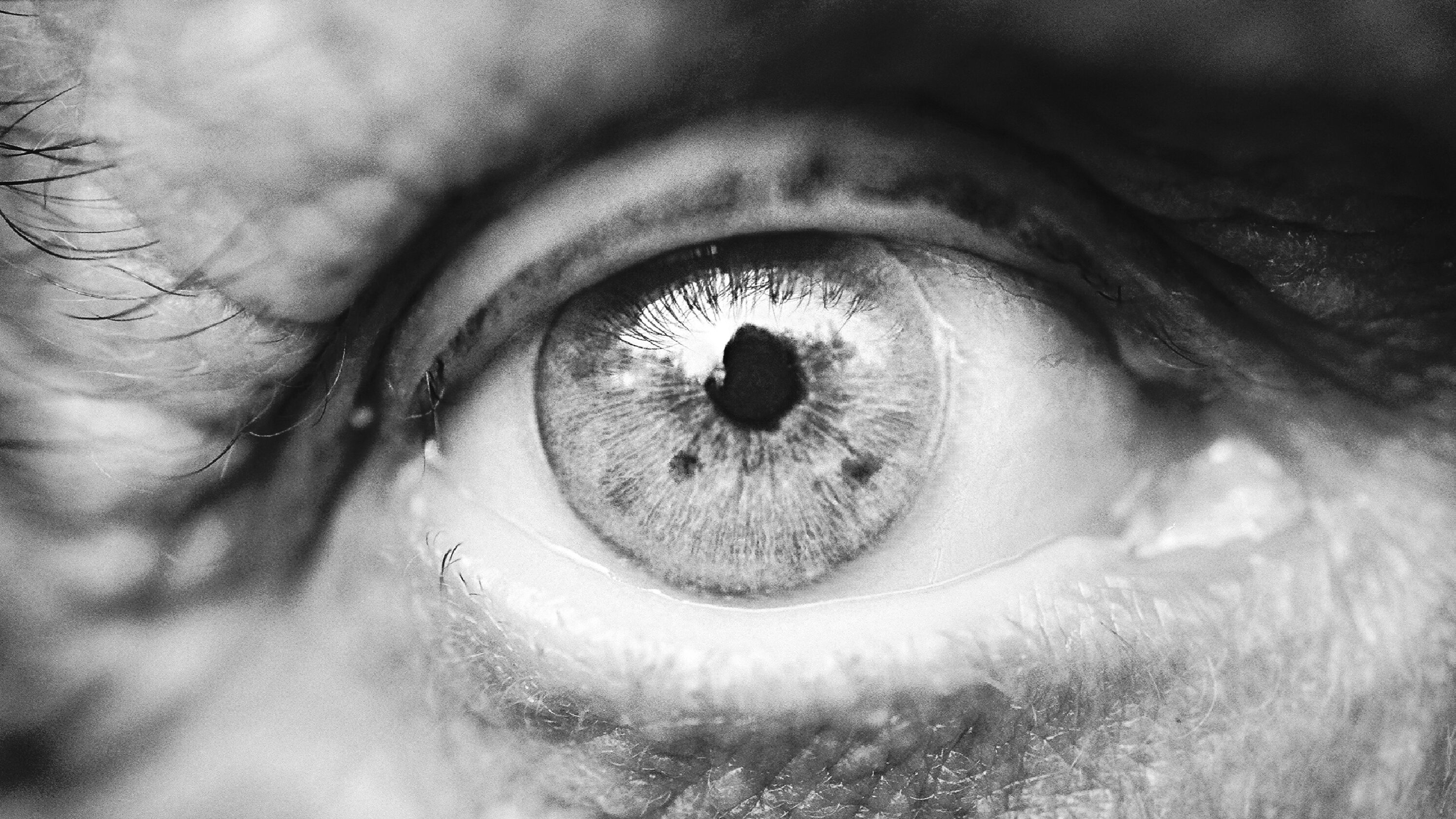 Understanding Cataract Surgery: A Simple Guide for Seniors